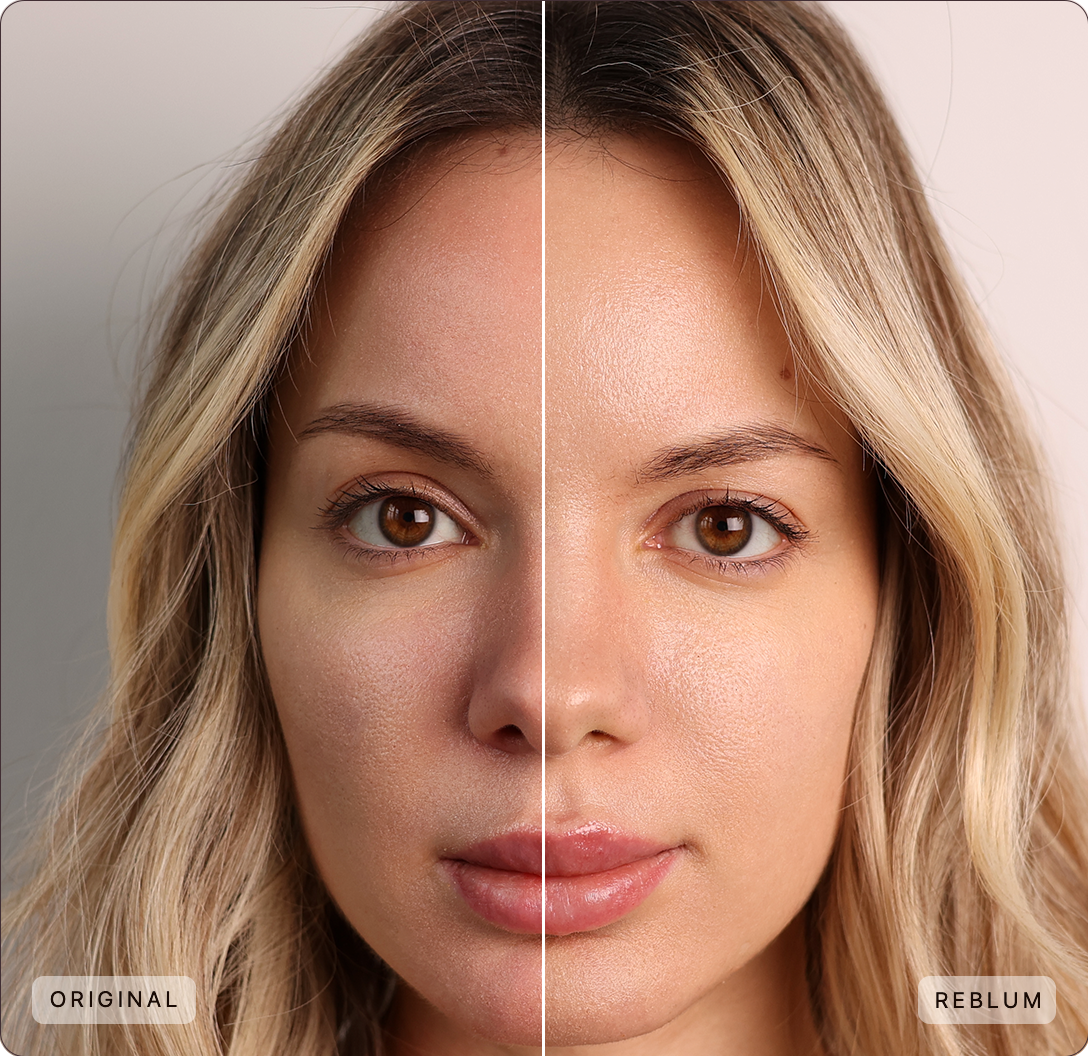 Images quality comparison